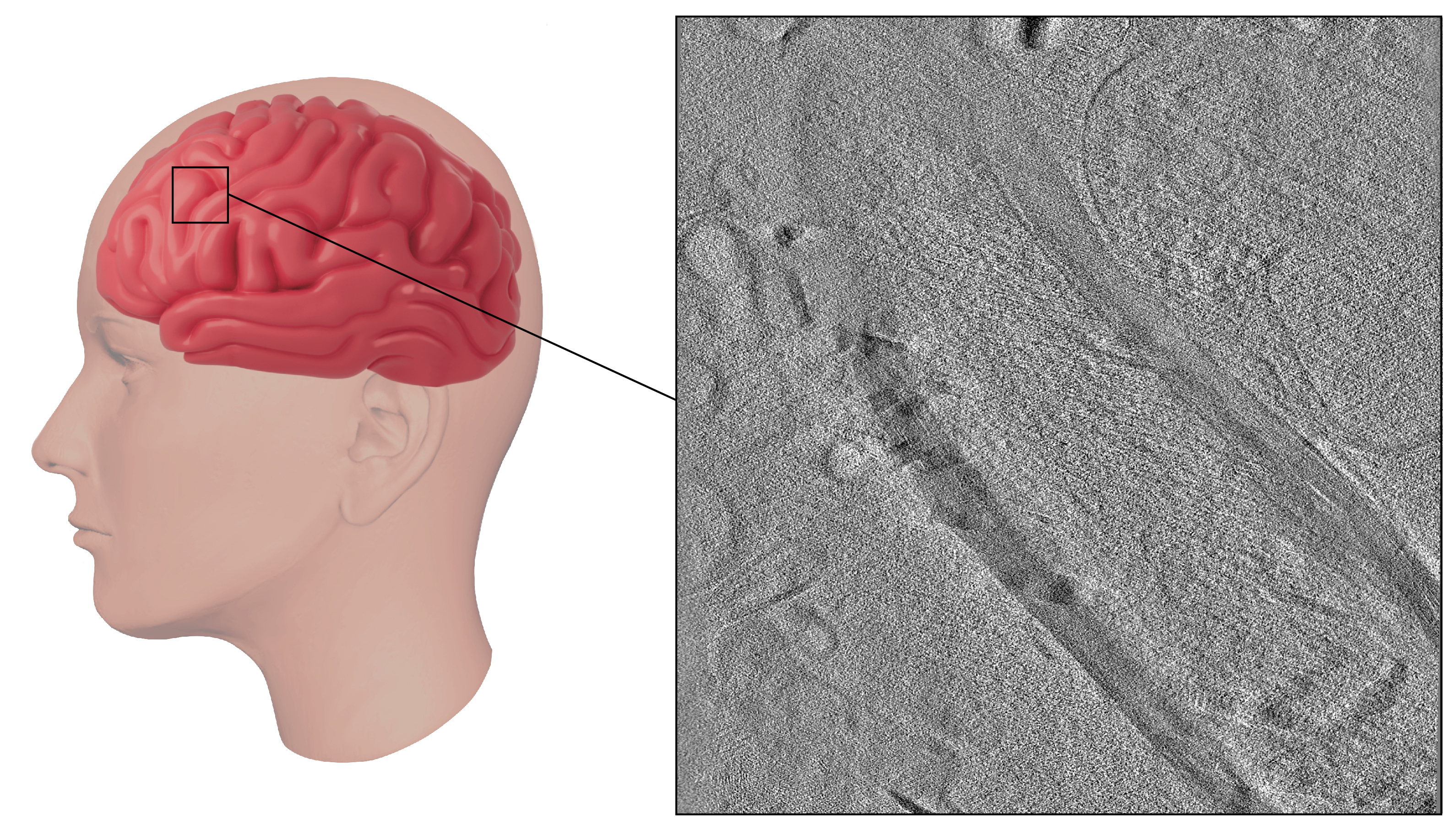 A close-up of a human headDescription automatically generated