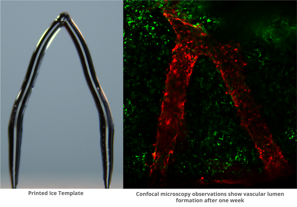 3D Ice Printing can Create Artificial Blood Vessels in Engineered Tissue