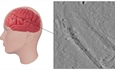 Using Ion Beams to Improve Brain Microscopy