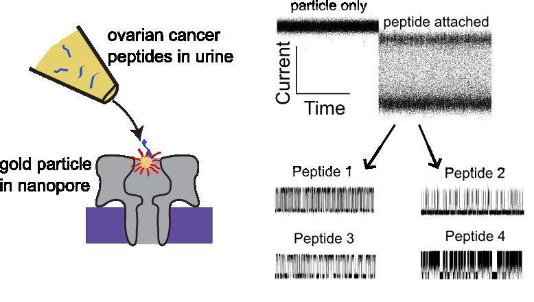 New Method Could Detect Early Ovarian Cancer from Urine Samples