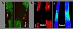 Using Biophysics to Uncover the Mechanisms of Neuromuscular Degeneration in ALS